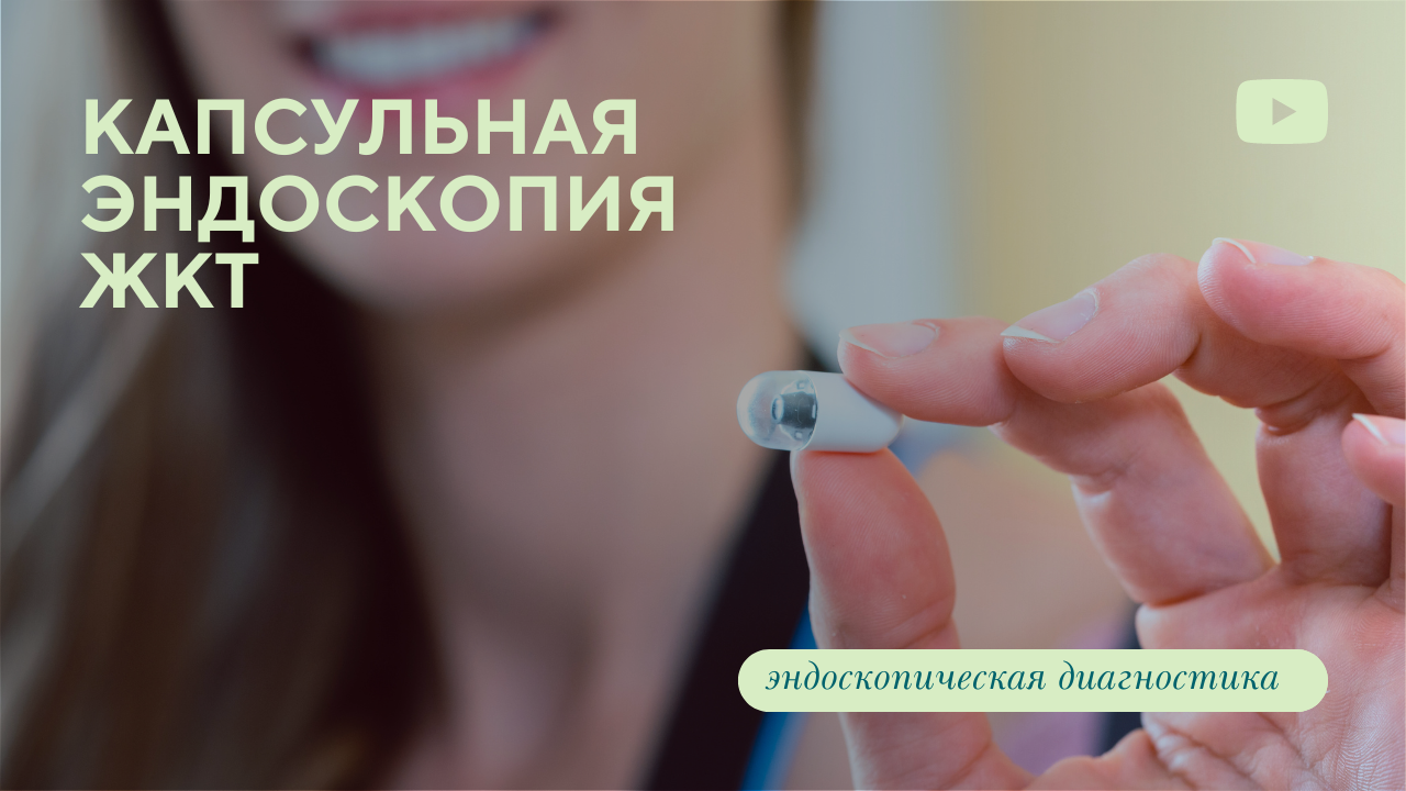 Капсульная эндоскопия - нарисованный ролик.