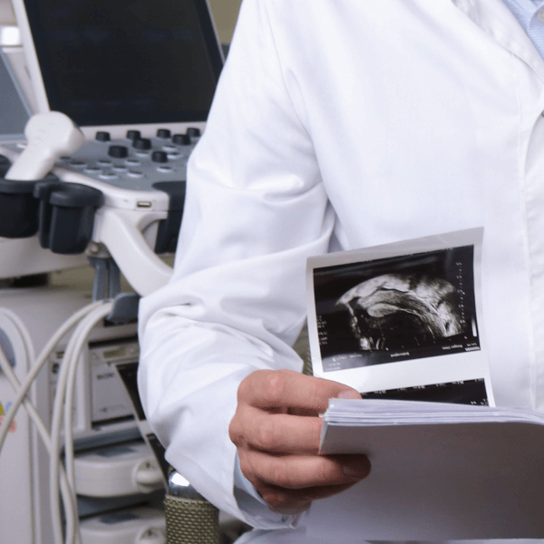 Варикоз при беременности: не приговор, а повод для внимания к себе