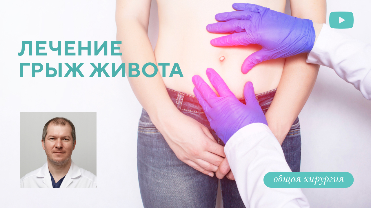 Лечение грыж живота (пупочных, вентральных, грыж белой линии живота). (Гребцов Ю.В.)