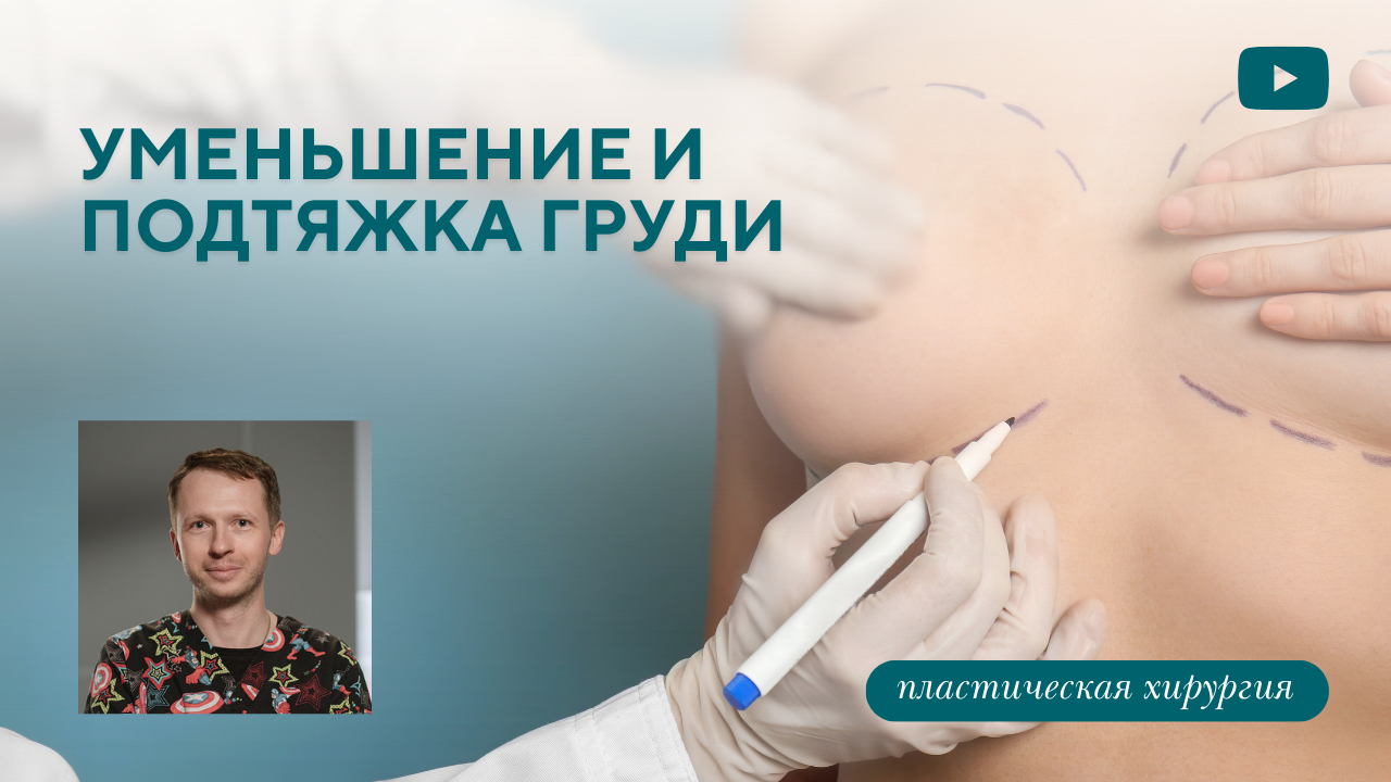 Уменьшение и подтяжка груди, коррекция втянутых сосков, тубулярная грудь - всё о коррекции сложной груди (Барсаков М.А.)