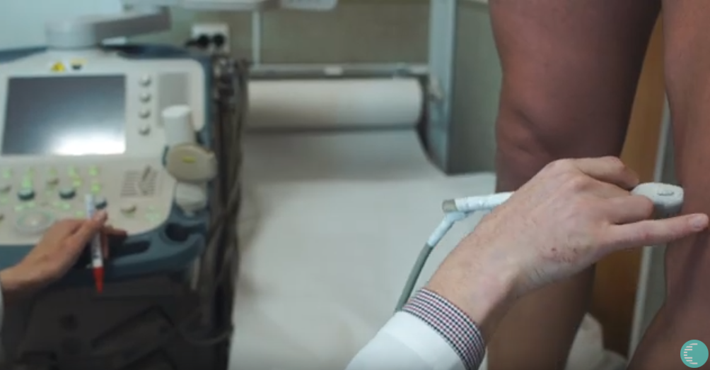 Лечение варикоза методом РЧА (радиочастотной абляции) (Дука М.Л.)