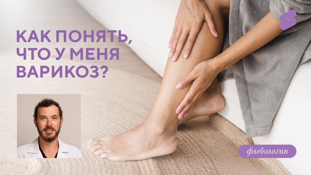 Как понять, что у меня варикоз? (Семиголовский С.Н.)