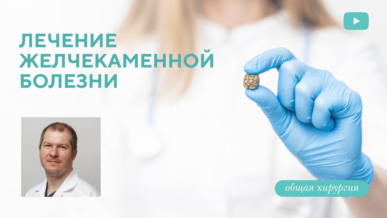 Лечение желчекаменной болезни. (Гребцов Ю.В.)